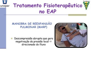Tratamento FisioterapêuticoTratamento Fisioterapêutico
no EAPno EAP
MANOBRA DE REEXPANSÃO
PULMONAR (MARP)
 Descompressão abrupta que gera
negativação da pressão local 
direcionado do fluxo
 