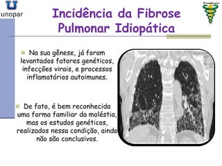 Incidência da FibroseIncidência da Fibrose
Pulmonar IdiopáticaPulmonar Idiopática
 Na sua gênese, já foram
levantados fatores genéticos,
infecções virais, e processos
inflamatórios autoimunes.
 De fato, é bem reconhecida
uma forma familiar da moléstia,
mas os estudos genéticos,
realizados nessa condição, ainda
não são conclusivos.
 