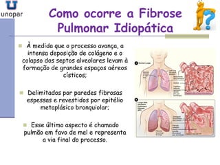 Como ocorre a FibroseComo ocorre a Fibrose
Pulmonar IdiopáticaPulmonar Idiopática
 À medida que o processo avança, a
intensa deposição de colágeno e o
colapso dos septos alveolares levam à
formação de grandes espaços aéreos
císticos;
 Delimitados por paredes fibrosas
espessas e revestidos por epitélio
metaplásico bronquiolar;
 Esse último aspecto é chamado
pulmão em favo de mel e representa
a via final do processo.
 