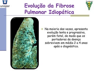 Evolução da FibroseEvolução da Fibrose
Pulmonar IdiopáticaPulmonar Idiopática
 Na maioria das vezes, apresenta
evolução lenta e progressiva,
porém fatal, de modo que os
portadores da doença
sobrevivem em média 2 a 4 anos
após o diagnóstico.
 