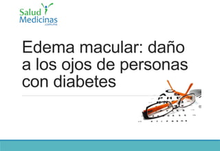 Edema macular: daño
a los ojos de personas
con diabetes
 