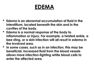 EDEMA
 Edema is an abnormal accumulation of fluid in the
interstitium, located beneath the skin and in the
cavities of the body.
 Edema is a normal response of the body to
inflammation or injury. For example, a twisted ankle, a
bee sting, or a skin infection will all result in edema in
the involved area.
 In some cases, such as in an infection, this may be
beneficial. Increased fluid from the blood vessels
allows more infection-fighting white blood cells to
enter the affected area.
 