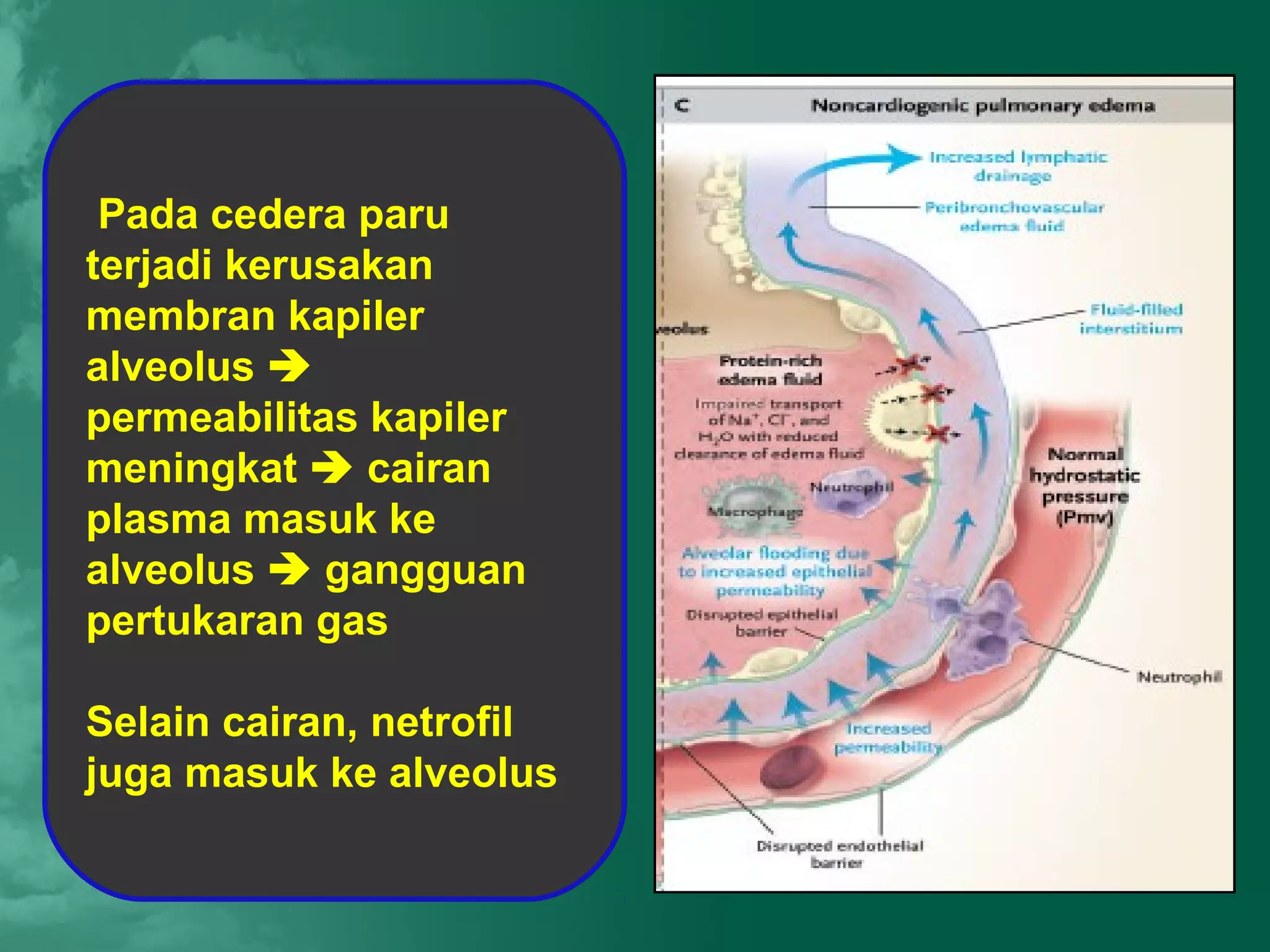 Pada cedera paru
terjadi kerusakan
membran kapiler
alveolus 
permeabilitas kapiler
meningkat  cairan
plasma masuk ke
alveolus  gangguan
pertukaran gas

Selain cairan, netrofil
juga masuk ke alveolus
 