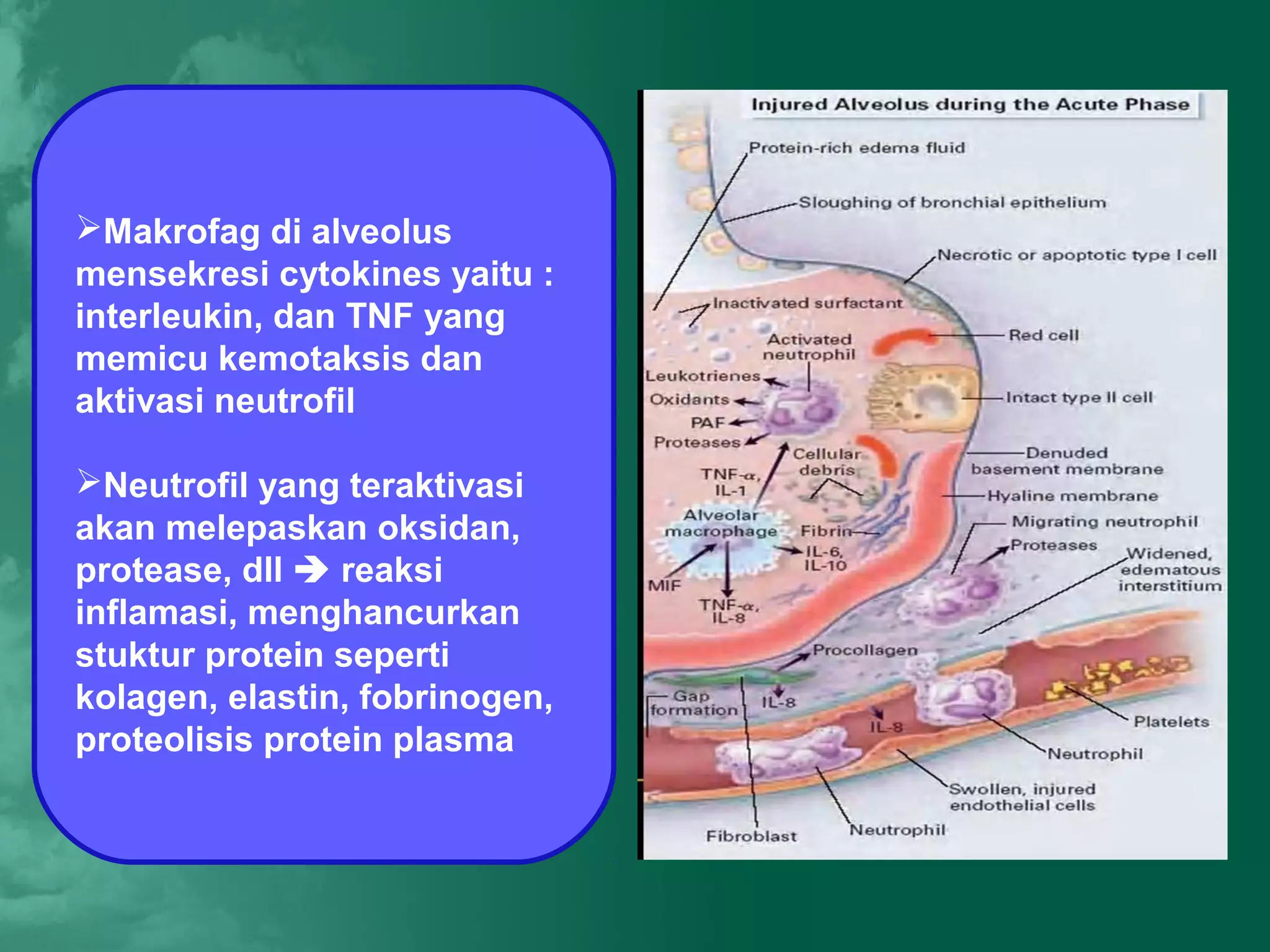 Makrofag di alveolus
mensekresi cytokines yaitu :
interleukin, dan TNF yang
memicu kemotaksis dan
aktivasi neutrofil

Neutrofil yang teraktivasi
akan melepaskan oksidan,
protease, dll  reaksi
inflamasi, menghancurkan
stuktur protein seperti
kolagen, elastin, fobrinogen,
proteolisis protein plasma
 