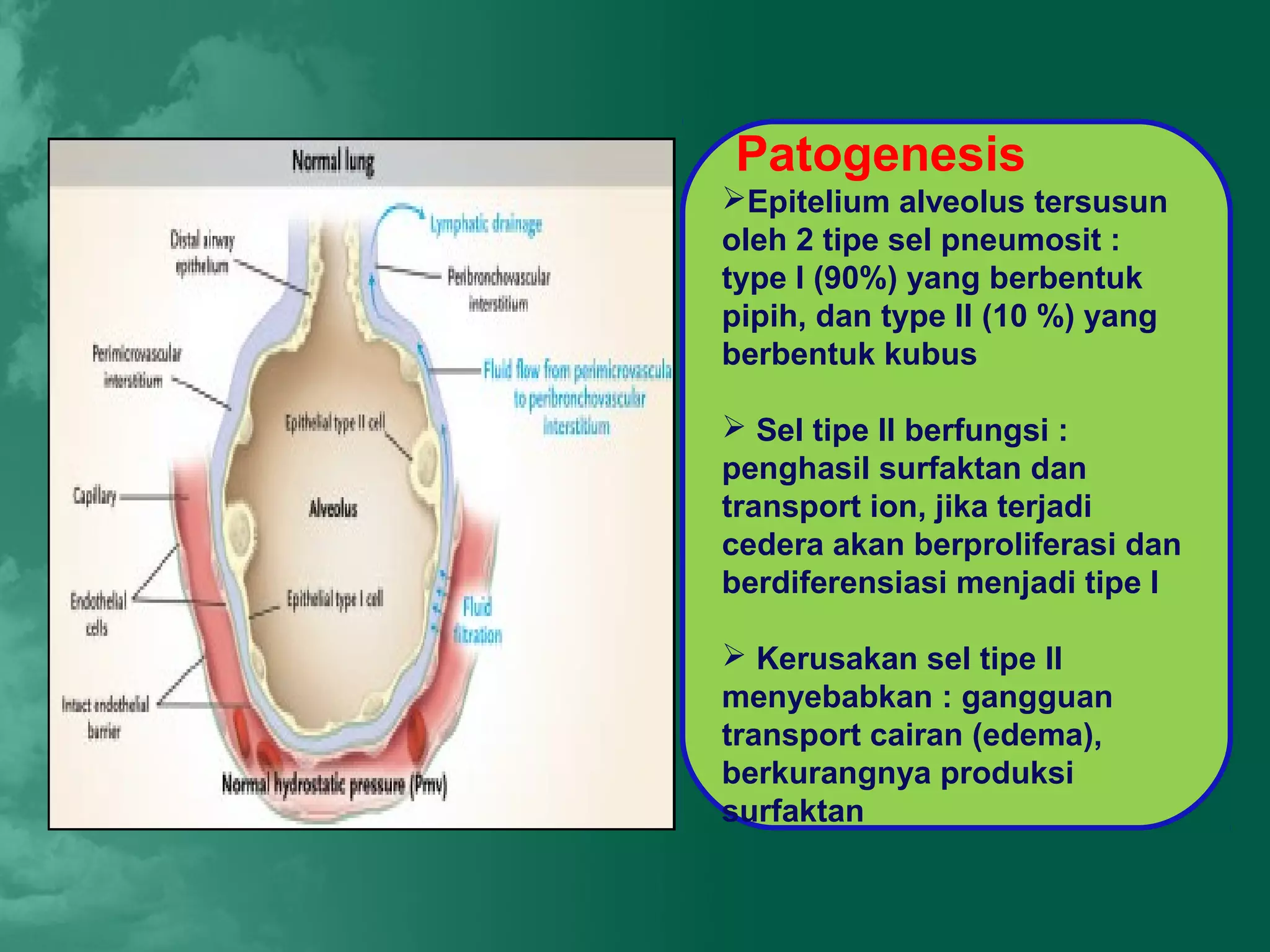 Patogenesis
Epitelium alveolus tersusun
oleh 2 tipe sel pneumosit :
type I (90%) yang berbentuk
pipih, dan type II (10 %) yang
berbentuk kubus

 Sel tipe II berfungsi :
penghasil surfaktan dan
transport ion, jika terjadi
cedera akan berproliferasi dan
berdiferensiasi menjadi tipe I

 Kerusakan sel tipe II
menyebabkan : gangguan
transport cairan (edema),
berkurangnya produksi
surfaktan
 