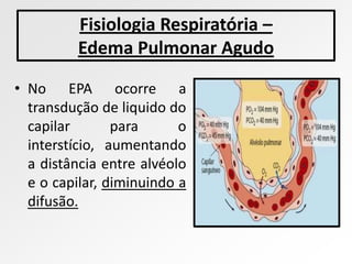 Fisiologia Respiratória –
         Edema Pulmonar Agudo

• No EPA ocorre a
  transdução de liquido do
  capilar       para      o
  interstício, aumentando
  a distância entre alvéolo
  e o capilar, diminuindo a
  difusão.
 