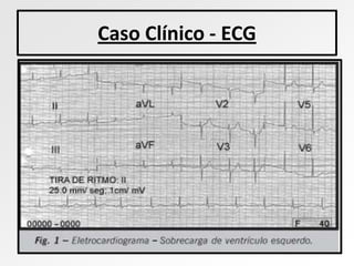Caso Clínico - ECG
 