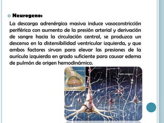  Neurogeno:
La descarga adrenérgica masiva induce vasoconstricción
periférica con aumento de la presión arterial y derivación
de sangre hacia la circulación central, se produzca un
descenso en la distensibilidad ventricular izquierda, y que
ambos factores sirvan para elevar las presiones de la
aurícula izquierda en grado suficiente para causar edema
de pulmón de origen hemodinámico.
 