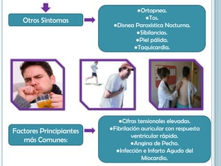 Otros Síntomas
●Ortopnea.
●Tos.
●Disnea Paroxística Nocturna.
●Sibilancias.
●Piel pálida.
●Taquicardia.
Factores Principiantes
más Comunes:
●Cifras tensionales elevadas.
●Fibrilación auricular con respuesta
ventricular rápida.
●Angina de Pecho.
●Infección e Infarto Agudo del
Miocardio.
 