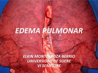 EDEMA PULMONAR
ELKIN MONTERROZA BERRIO
UNIVERSIDAD DE SUCRE
VI SEMESTRE
 
