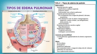 TIPOS DE EDEMA PULMONAR
 