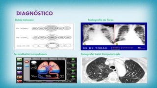 DIAGNÓSTICO
Doble Indicador
Termodilución transpulmonar
Radiografía de Tórax
Tomografía Axial Computarizada
 