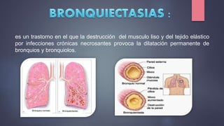 es un trastorno en el que la destrucción del musculo liso y del tejido elástico
por infecciones crónicas necrosantes provoca la dilatación permanente de
bronquios y bronquiolos.
 