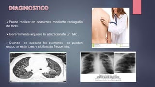 Puede realizar en ocasiones mediante radiografia
de tórax.
Generalmente requiere la utilización de un TAC .
Cuando se ausculta los pulmones se pueden
escuchar estertores y sibilancias frecuentes.
 