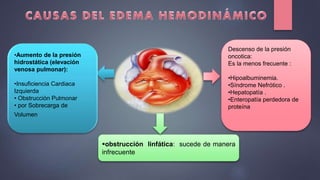 obstrucción linfática: sucede de manera
infrecuente
•Aumento de la presión
hidrostática (elevación
venosa pulmonar):
•Insuficiencia Cardiaca
Izquierda
• Obstrucción Pulmonar
• por Sobrecarga de
Volumen
Descenso de la presión
oncotica:
Es la menos frecuente :
•Hipoalbuminemia.
•Síndrome Nefrótico .
•Hepatopatía .
•Enteropatía perdedora de
proteína
 