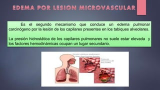 Es el segundo mecanismo que conduce un edema pulmonar
carcinógeno por la lesión de los capilares presentes en los tabiques alveolares.
La presión hidrostática de los capilares pulmonares no suele estar elevada y
los factores hemodinámicas ocupan un lugar secundario.
 