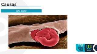 Causas
Daño Capilar
 
