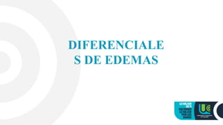 DIFERENCIALE
S DE EDEMAS
 