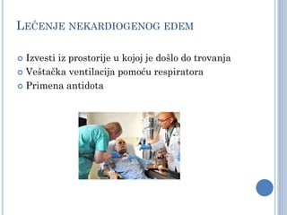 LEČENJE NEKARDIOGENOG EDEM
 Izvesti iz prostorije u kojoj je došlo do trovanja
 Veštačka ventilacija pomoću respiratora
 Primena antidota
 