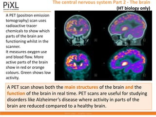 A PET (positron emission
tomography) scan uses
radioactive tracer
chemicals to show which
parts of the brain are
functioning whilst in the
scanner.
It measures oxygen use
and blood flow. More
active parts of the brain
show in red or orange
colours. Green shows low
activity.
A PET scan shows both the main structures of the brain and the
function of the brain in real time. PET scans are useful for studying
disorders like Alzheimer’s disease where activity in parts of the
brain are reduced compared to a healthy brain.
The central nervous system Part 2 - The brain
(HT biology only)
 
