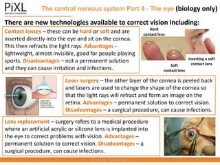 The central nervous system Part 4 - The eye (biology only)
There are new technologies available to correct vision including:
Contact lenses – these can be hard or soft and are
inserted directly into the eye and sit on the cornea.
This then refracts the light rays. Advantages -
lightweight, almost invisible, good for people playing
sports. Disadvantages – not a permanent solution
and they can cause irritation and infections.
Hard
contact lens
Soft
contact lens
Inserting a soft
contact lens
Laser surgery – the other layer of the cornea is peeled back
and lasers are used to change the shape of the cornea so
that the light rays will refract and form an image on the
retina. Advantages – permanent solution to correct vision.
Disadvantages – a surgical procedure, can cause infections.
Lens replacement – surgery refers to a medical procedure
where an artificial acrylic or silicone lens is implanted into
the eye to correct problems with vision. Advantages –
permanent solution to correct vision. Disadvantages – a
surgical procedure, can cause infections.
 