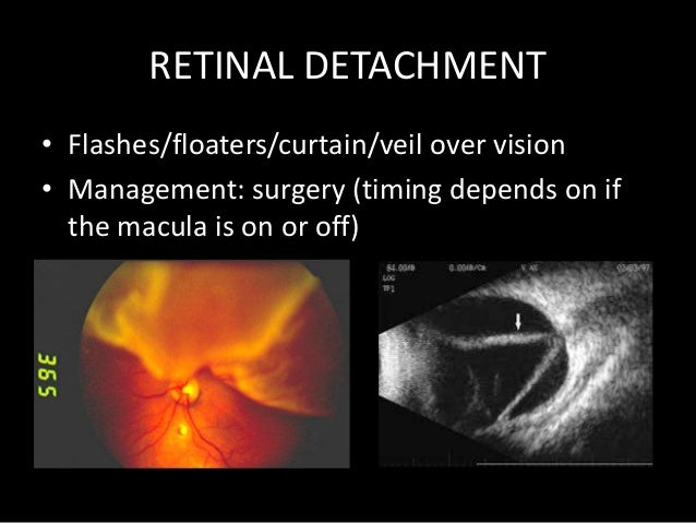 Emergency department eye presentations