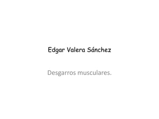 Edgar Valera Sánchez

Desgarros musculares.

 