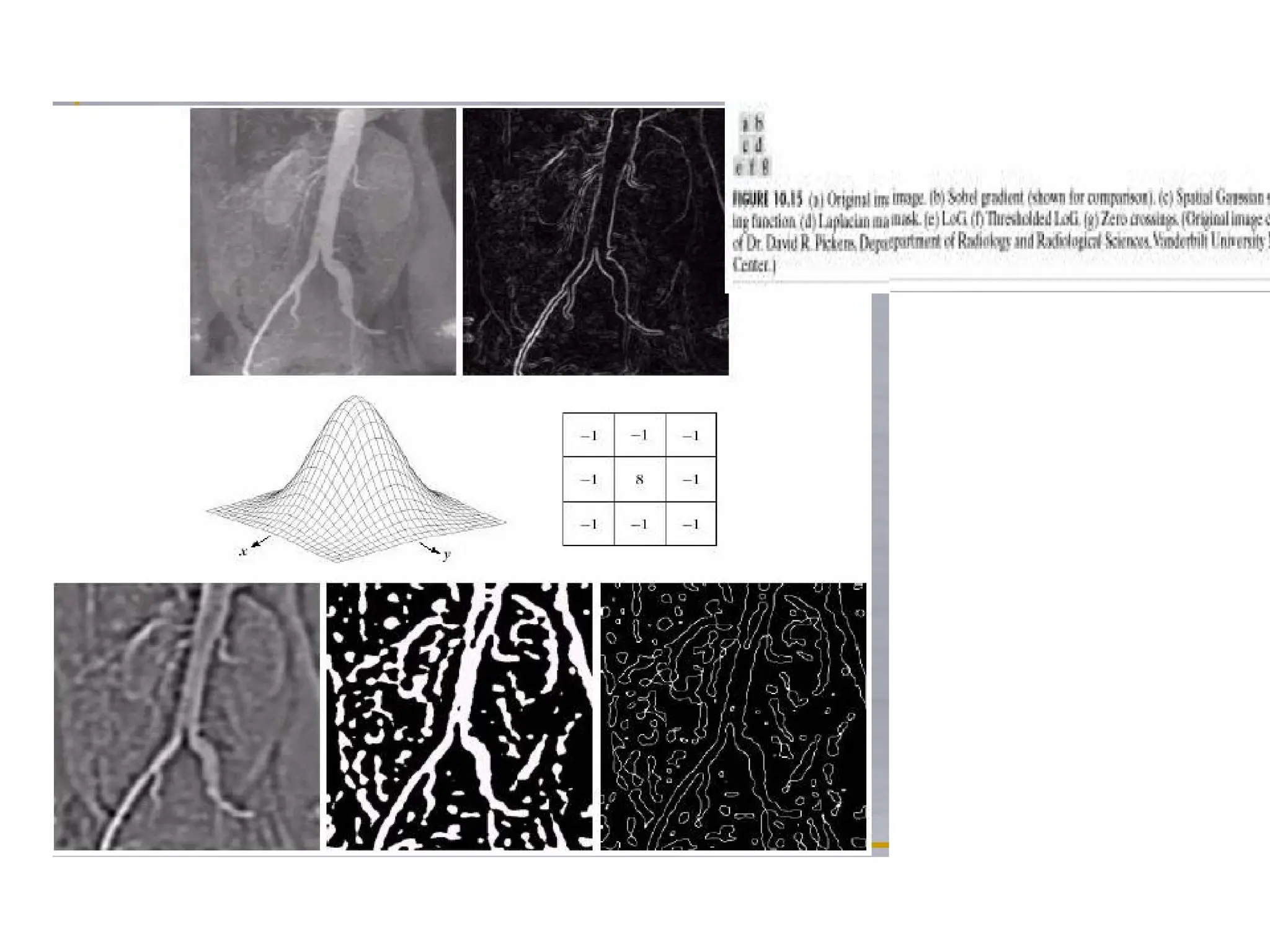 EDGEDETECTION algorithm and theory for image processing | PPT