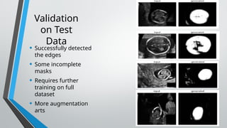 Edge Detection : Edge Detection: A Comparison of Statistical Methods ...