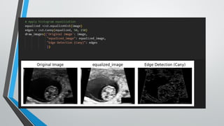 Edge Detection : Edge Detection: A Comparison of Statistical Methods ...