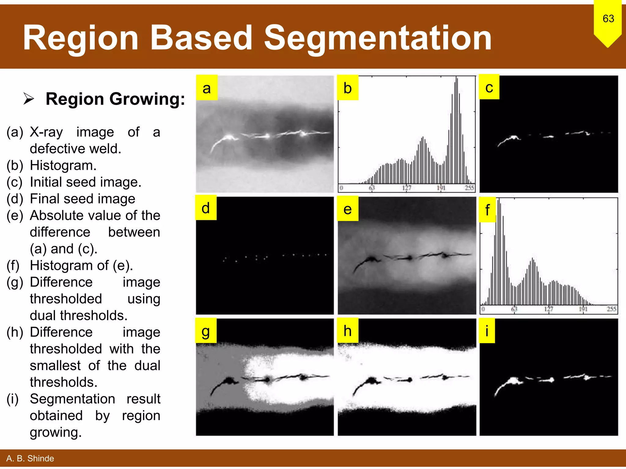 A. B. Shinde
Region Based Segmentation
 Region Growing:
63
(a) X-ray image of a
defective weld.
(b) Histogram.
(c) Initial seed image.
(d) Final seed image
(e) Absolute value of the
difference between
(a) and (c).
(f) Histogram of (e).
(g) Difference image
thresholded using
dual thresholds.
(h) Difference image
thresholded with the
smallest of the dual
thresholds.
(i) Segmentation result
obtained by region
growing.
a b c
d e f
g h i
 