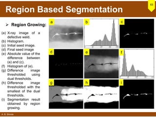 A. B. Shinde
Region Based Segmentation
 Region Growing:
63
(a) X-ray image of a
defective weld.
(b) Histogram.
(c) Initial seed image.
(d) Final seed image
(e) Absolute value of the
difference between
(a) and (c).
(f) Histogram of (e).
(g) Difference image
thresholded using
dual thresholds.
(h) Difference image
thresholded with the
smallest of the dual
thresholds.
(i) Segmentation result
obtained by region
growing.
a b c
d e f
g h i
 