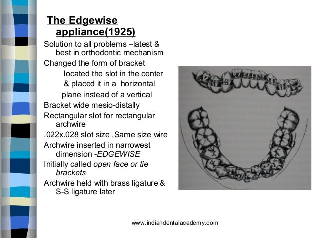 edgewise appliance evolution and technique edgewise appliance