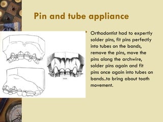 Pin Tube Tooth EDGEWISE PHILOSPHY,MDS,ORTHODONTICS AND DENTOFACIAL ORTHOPAEDICS | PPT