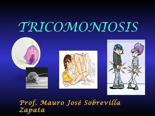 TRICOMONIOSIS
Prof. Mauro José Sobrevilla
Zapata
 