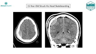 15-Year-Old Struck His Head Skateboarding
 