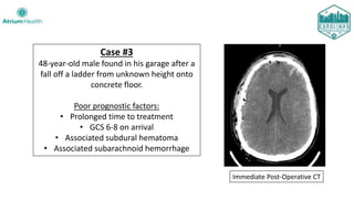 Case #3
48-year-old male found in his garage after a
fall off a ladder from unknown height onto
concrete floor.
Poor prognostic factors:
• Prolonged time to treatment
• GCS 6-8 on arrival
• Associated subdural hematoma
• Associated subarachnoid hemorrhage
Immediate Post-Operative CT
 