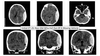 Initial CT: 21-Year-Old Who Fell Out Of A Moving Vehicle
 