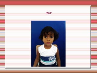 RAY
 
