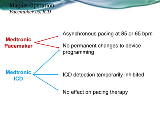 Magnet Operation
Pacemaker vs. ICD
Medtronic
ICD
Medtronic
Pacemaker
Asynchronous pacing at 85 or 65 bpm
ICD detection temporarily inhibited
No permanent changes to device
programming
No effect on pacing therapy
 