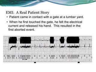 EMI: A Real Patient Story
• Patient came in contact with a gate at a lumber yard.
• When he first touched the gate, he felt the electrical
current and released his hand. This resulted in the
first aborted event.
 