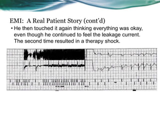 EMI: A Real Patient Story (cont’d)
• He then touched it again thinking everything was okay,
even though he continued to feel the leakage current.
The second time resulted in a therapy shock.
 