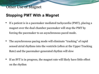 Other Use of Magnet
• If a patient is in a pacemaker mediated tachycardia (PMT), placing a
magnet over the dual chamber pacemaker will stop the PMT by
forcing the pacemaker to an asynchronous paced mode.
• The asynchronous pacing mode will eliminate “tracking” of rapid
sensed atrial rhythms into the ventricle (often at the Upper Tracking
Rate) and the pacemaker-generated rhythm will slow
• If an SVT is in progress, the magnet rate will likely have little effect
on the rhythm
Stopping PMT With a Magnet
 