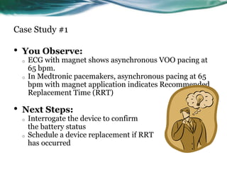 Case Study #1
• You Observe:
o ECG with magnet shows asynchronous VOO pacing at
65 bpm.
o In Medtronic pacemakers, asynchronous pacing at 65
bpm with magnet application indicates Recommended
Replacement Time (RRT)
• Next Steps:
o Interrogate the device to confirm
the battery status
o Schedule a device replacement if RRT
has occurred
 