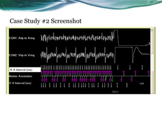 Case Study #2 Screenshot
 