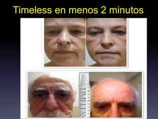 Timeless en menos 2 minutos
 