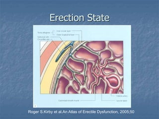 Erection State
Roger S.Kirby et al.An Atlas of Erectile Dysfunction, 2005;50
 