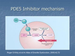 PDE5 Inhibitor mechanism
Roger S.Kirby et al.An Atlas of Erectile Dysfunction, 2005;42,72
 