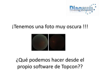 ¡Tenemos una foto muy oscura !!!




 ¿Qué podemos hacer desde el
  propio software de Topcon??
 