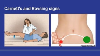 Carnett Sign Negative Acute abdominal pain evaluation in emergency department | PDF